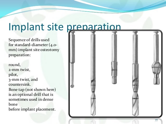surgical guide for dental implant placement ppt